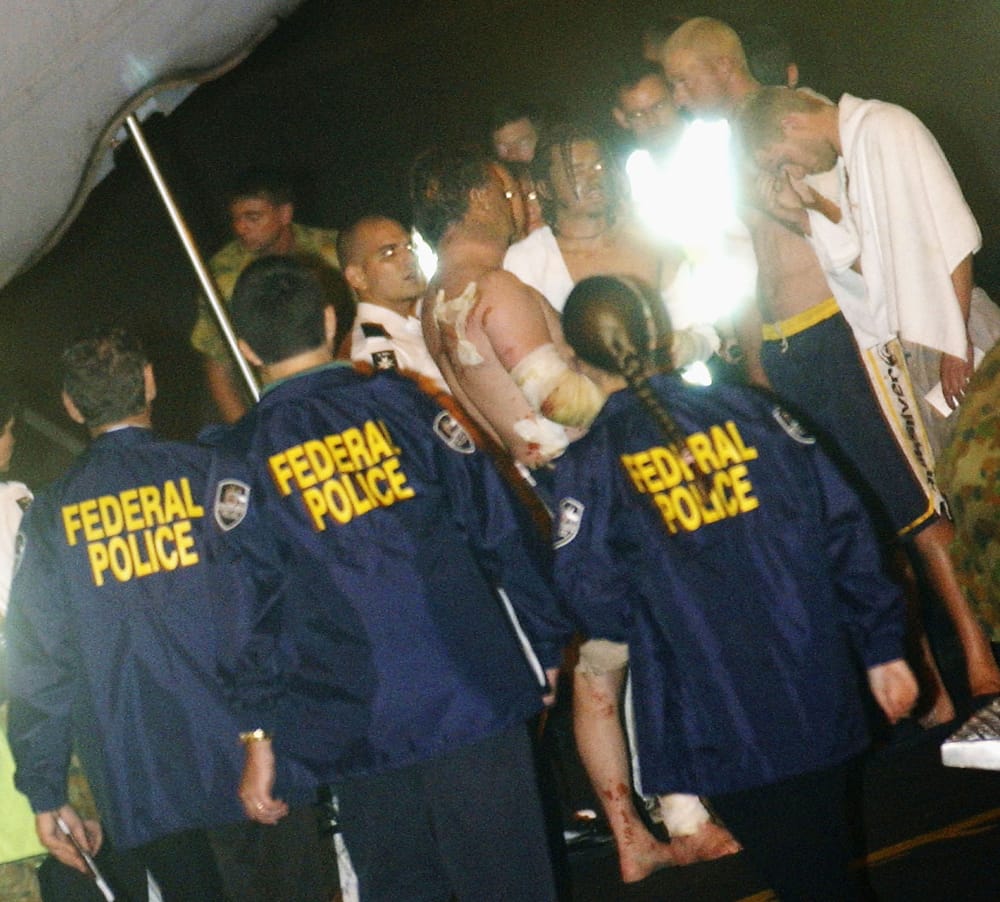 Victims injured in the Bali nightclub bombing after arriving in Darwin, Australia, on the first RAAF flight from Indonesia, 14 October 2002 (Getty Images)